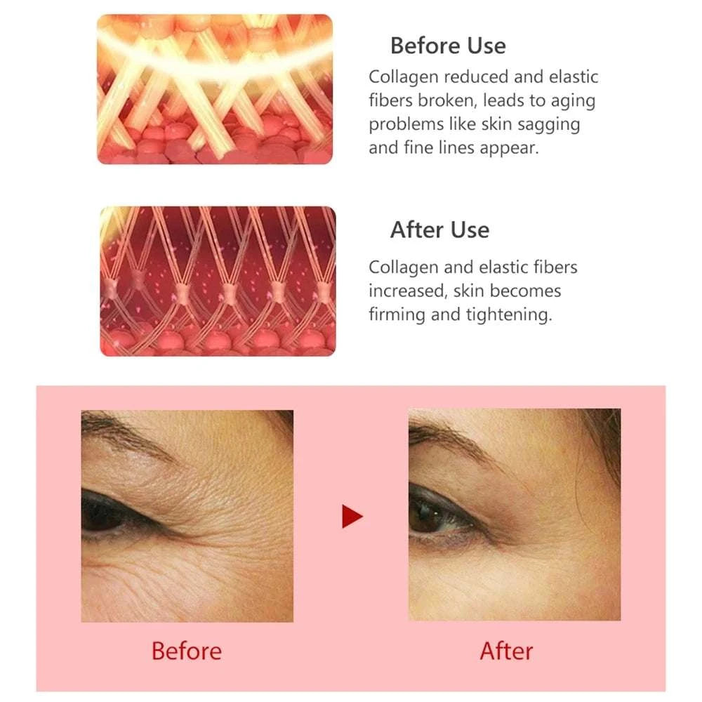 Radio Frequency For Eyes Massage Anti Wrinkles Pen RF Lifting Red Light Therapy Portable Facial Appliances For Beauty