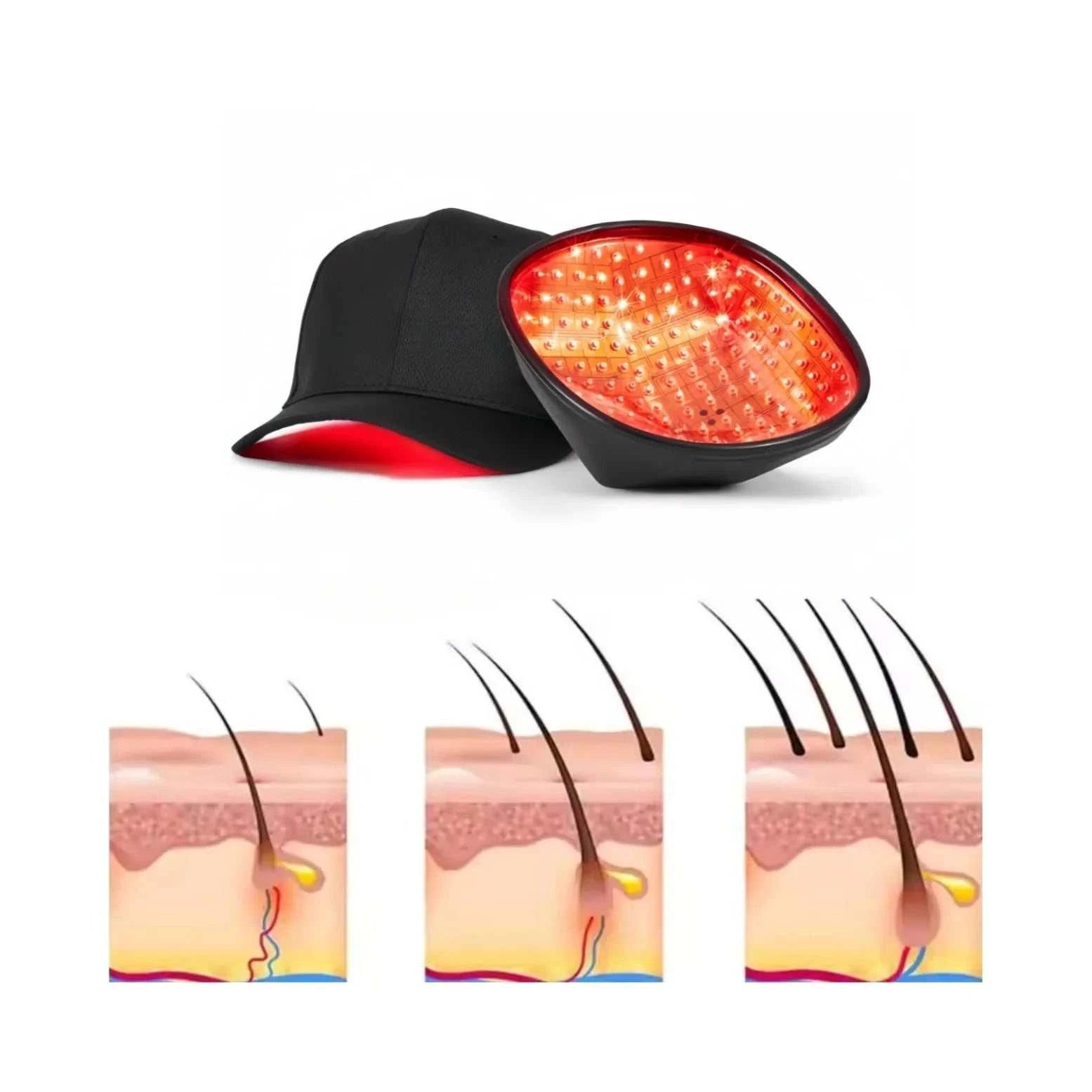 COZING Rechargeable LLLT Hair Growth Cap 650nm Red Light Therapy Loss Scalp Health