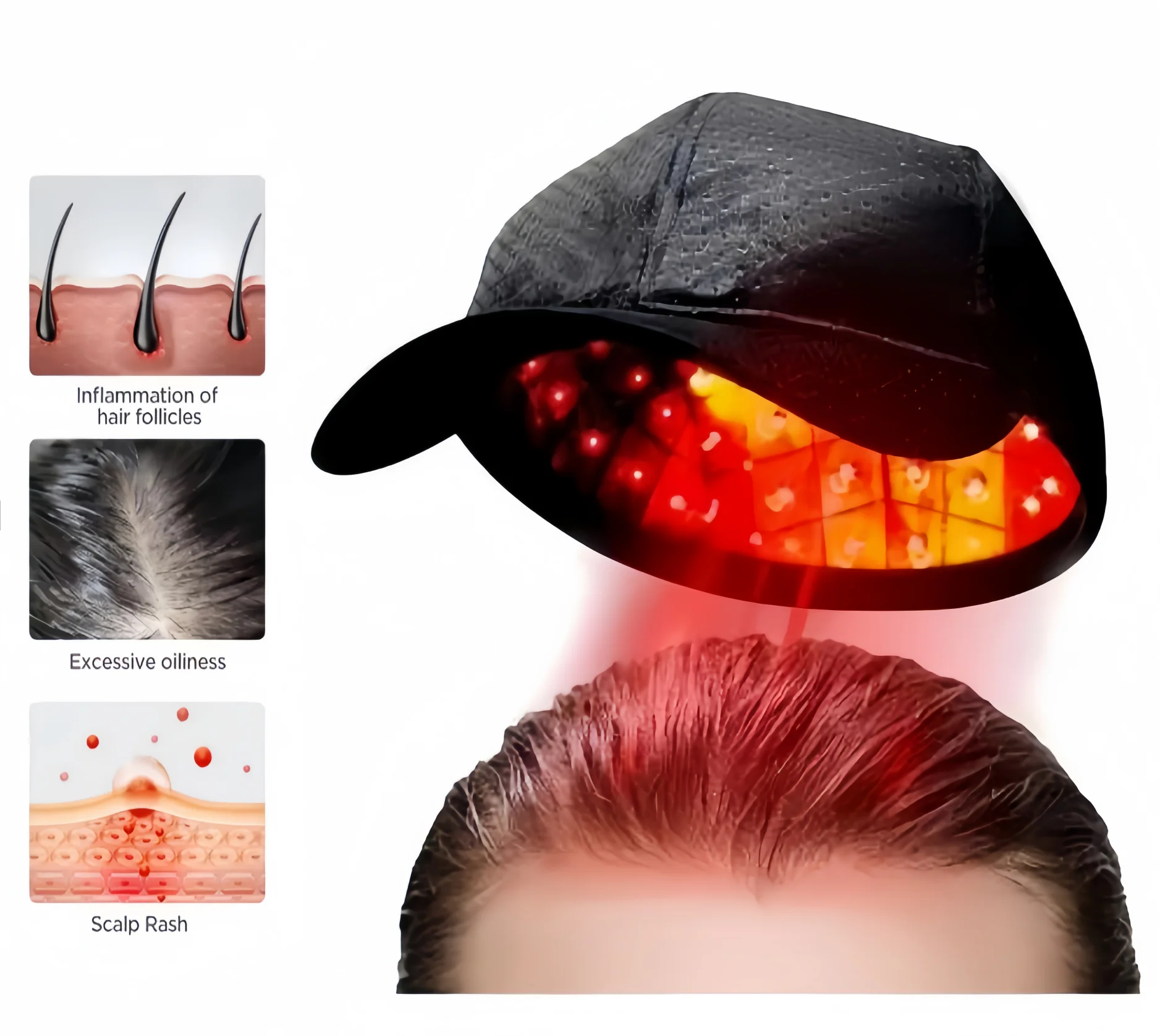 COZING Rechargeable LLLT Hair Growth Cap 650nm Red Light Therapy Loss Scalp Health