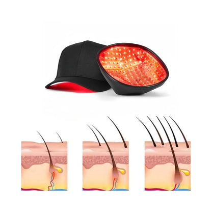 COZING Rechargeable LLLT Hair Growth Cap 650nm Red Light Therapy  Loss Scalp Health