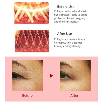 Radio Frequency For Eyes Massage Anti Wrinkles Pen RF Lifting Red Light Therapy Portable Facial Appliances For Beauty