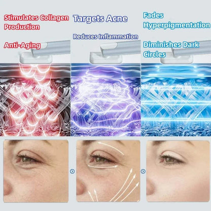 7 Colors Red Light Facial Wand EMS Microcurrent Face Lifting Device Eye Neck Massager Skin Tightening Skin Care Beauty Tool